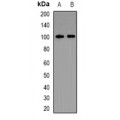 LifeSab™ Calcitonin Rabbit pAb (50 µl)