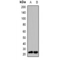 LifeSab™ TSC1 Rabbit pAb (50 µl)