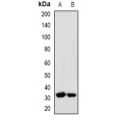 LifeSab™ FGF11 Rabbit pAb (50 µl)