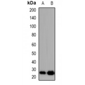 LifeSab™ ZFP91 Rabbit pAb (50 µl)