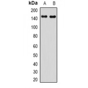 LifeSab™ Complement C8 beta Rabbit pAb (50 µl)