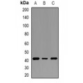 LifeSab™ VPS35 Rabbit pAb (50 µl)