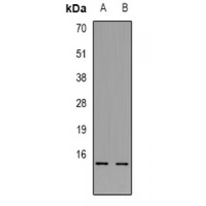 LifeSab™ TRP2 Rabbit pAb (50 µl)