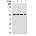 LifeSab™ Hemopexin Rabbit pAb (50 µl)