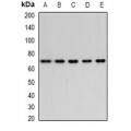 LifeSab™ Bestrophin Rabbit pAb (50 µl)