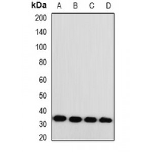 LifeSab™ Monoglyceride Lipase Rabbit pAb (50 µl)