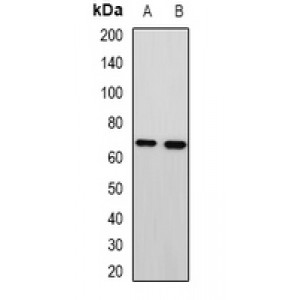 LifeSab™ MTA3 Rabbit pAb (50 µl)