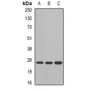 LifeSab™ GSTM4 Rabbit pAb (50 µl)