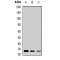 LifeSab™ MSRB3 Rabbit pAb (50 µl)