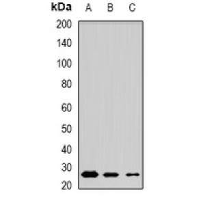 LifeSab™ MSRB3 Rabbit pAb (50 µl)