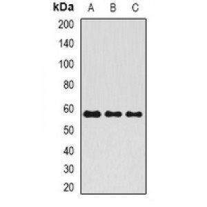 LifeSab™ ALPP Rabbit pAb (50 µl)