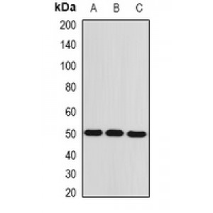 LifeSab™ AMACR Rabbit pAb (50 µl)