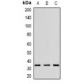 LifeSab™ CD152 Rabbit pAb (50 µl)