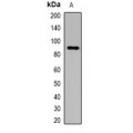 LifeSab™ Gelsolin Rabbit pAb (50 µl)