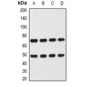 LifeSab™ Heparanase Rabbit pAb (50 µl)