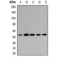 LifeSab™ PGD Rabbit pAb (50 µl)