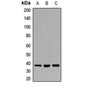 LifeSab™ RBM22 Rabbit pAb (50 µl)