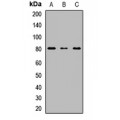 LifeSab™ UGT1A6 Rabbit pAb (50 µl)