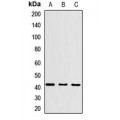 LifeSab™ HLA-C Rabbit pAb (50 µl)