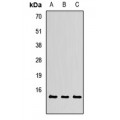 LifeSab™ TXNL4A Rabbit pAb (50 µl)