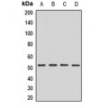 LifeSab™ FADS2 Rabbit pAb (50 µl)