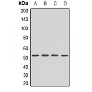 LifeSab™ FADS2 Rabbit pAb (50 µl)