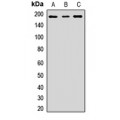 LifeSab™ NCOA2 Rabbit pAb (50 µl)