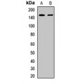 LifeSab™ LRIG1 Rabbit pAb (50 µl)