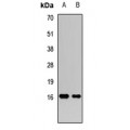 LifeSab™ FGF21 Rabbit pAb (50 µl)