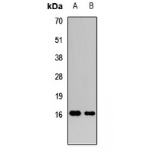 LifeSab™ FGF21 Rabbit pAb (50 µl)