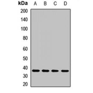 LifeSab™ Thymidylate Synthase Rabbit pAb (50 µl)