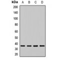 LifeSab™ PSMD14 Rabbit pAb (50 µl)