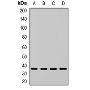 LifeSab™ PSMD14 Rabbit pAb (50 µl)