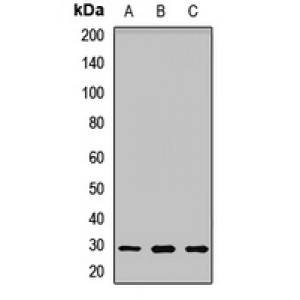 LifeSab™ UCK2 Rabbit pAb (50 µl)