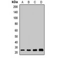 LifeSab™ ICT1 Rabbit pAb (50 µl)