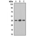 LifeSab™ MAT2B Rabbit pAb (50 µl)