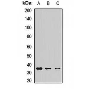 LifeSab™ CHMP1A Rabbit pAb (50 µl)