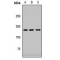 LifeSab™ ZCCHC11 Rabbit pAb (50 µl)