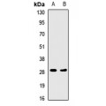 LifeSab™ HLA-DRA Rabbit pAb (50 µl)