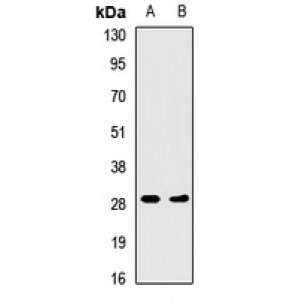 LifeSab™ HLA-DRA Rabbit pAb (50 µl)