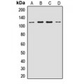 LifeSab™ ACAP2 Rabbit pAb (50 µl)