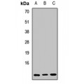 LifeSab™ Sm F Rabbit pAb (50 µl)