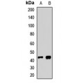 LifeSab™ AGER Rabbit pAb (50 µl)