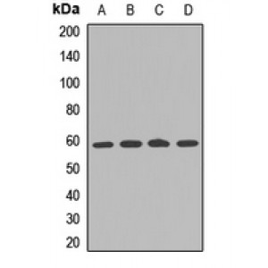 LifeSab™ IFNAR2 Rabbit pAb (50 µl)