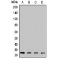 LifeSab™ RhoGDI beta Rabbit pAb (50 µl)