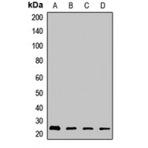 LifeSab™ RhoGDI beta Rabbit pAb (50 µl)