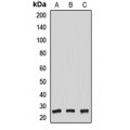 LifeSab™ NUDT21 Rabbit pAb (50 µl)