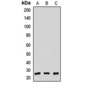 LifeSab™ NUDT21 Rabbit pAb (50 µl)