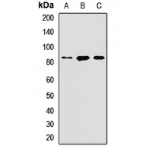 LifeSab™ LIV-1 Rabbit pAb (50 µl)