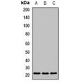 LifeSab™ UBE2F Rabbit pAb (50 µl)